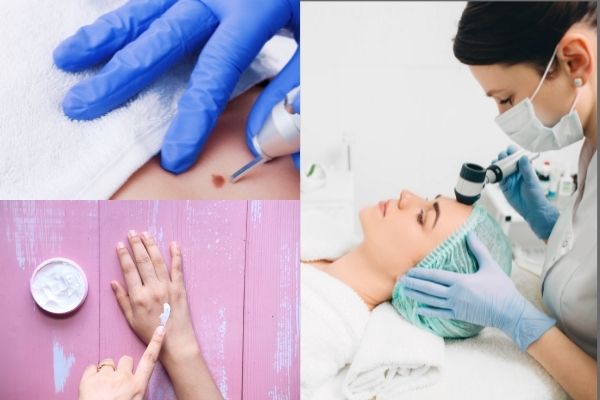 Bài giảng U hạt vòng (GRANULOMA ANNULARE)