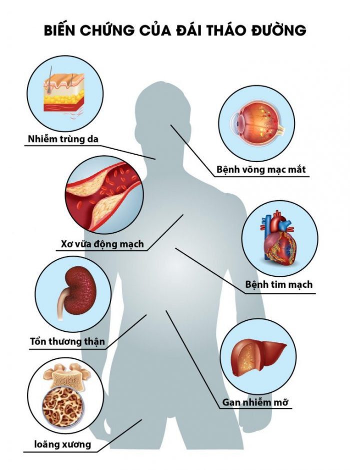 Bệnh Lý Cầu Thận Trong Đái Tháo Đường