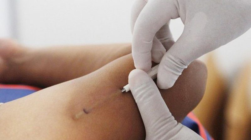 Cấy, Rút Mảnh Ghép Tránh Thai