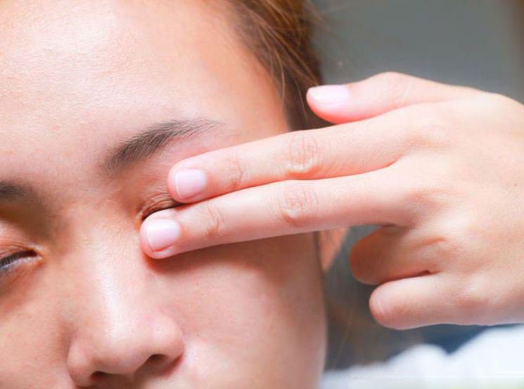 CHẨN ĐOÁN VÀ ĐIỀU TRỊ NHƯỢC CƠ