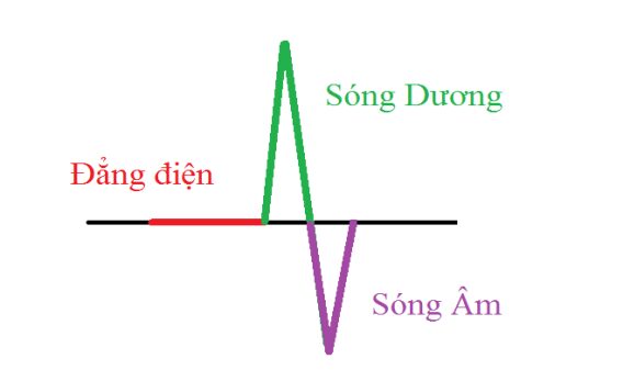 Đại cương về đo điện tâm đồ Đại cương về đo điện tâm đồ