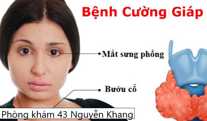 Điều trị cường giáp ở phụ nữ mang thai
