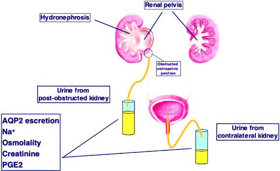 Độ thấm thấu niệu