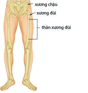 Gãy thân xương đùi ở trẻ em