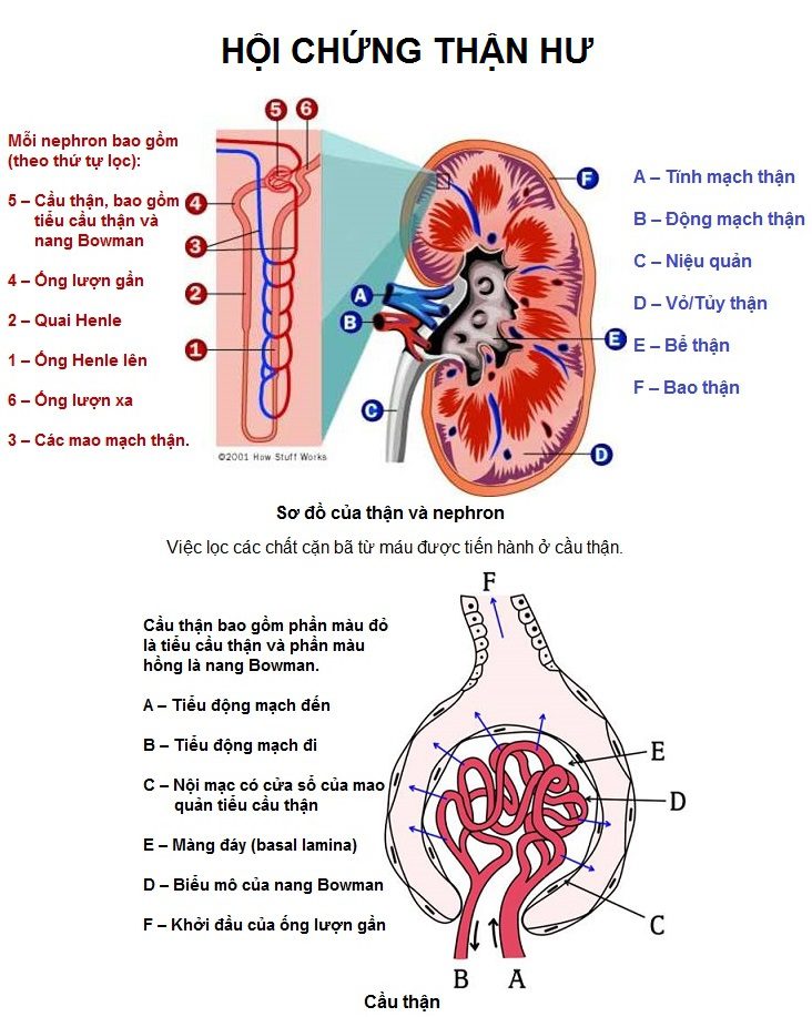 Hội Chứng Thận Hư