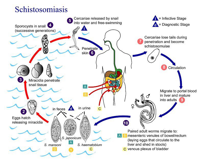 HƯỚNG DẪN CHẨN ĐOÁN VÀ ĐIỀU TRỊ BỆNH SÁN MÁNG PHỔI (PULMONARY SCHISTOSOMIASIS)