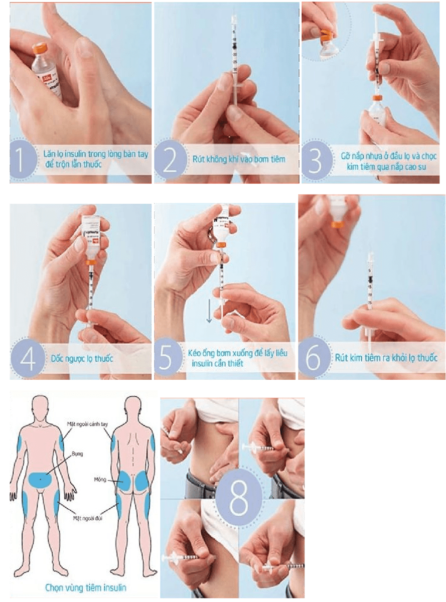 HƯỚNG DẪN KỸ THUẬT TIÊM INSULIN