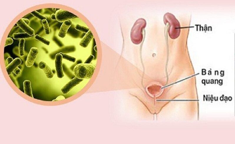 Lao tiết niệu- sinh dục Lao tiết niệu- sinh dục