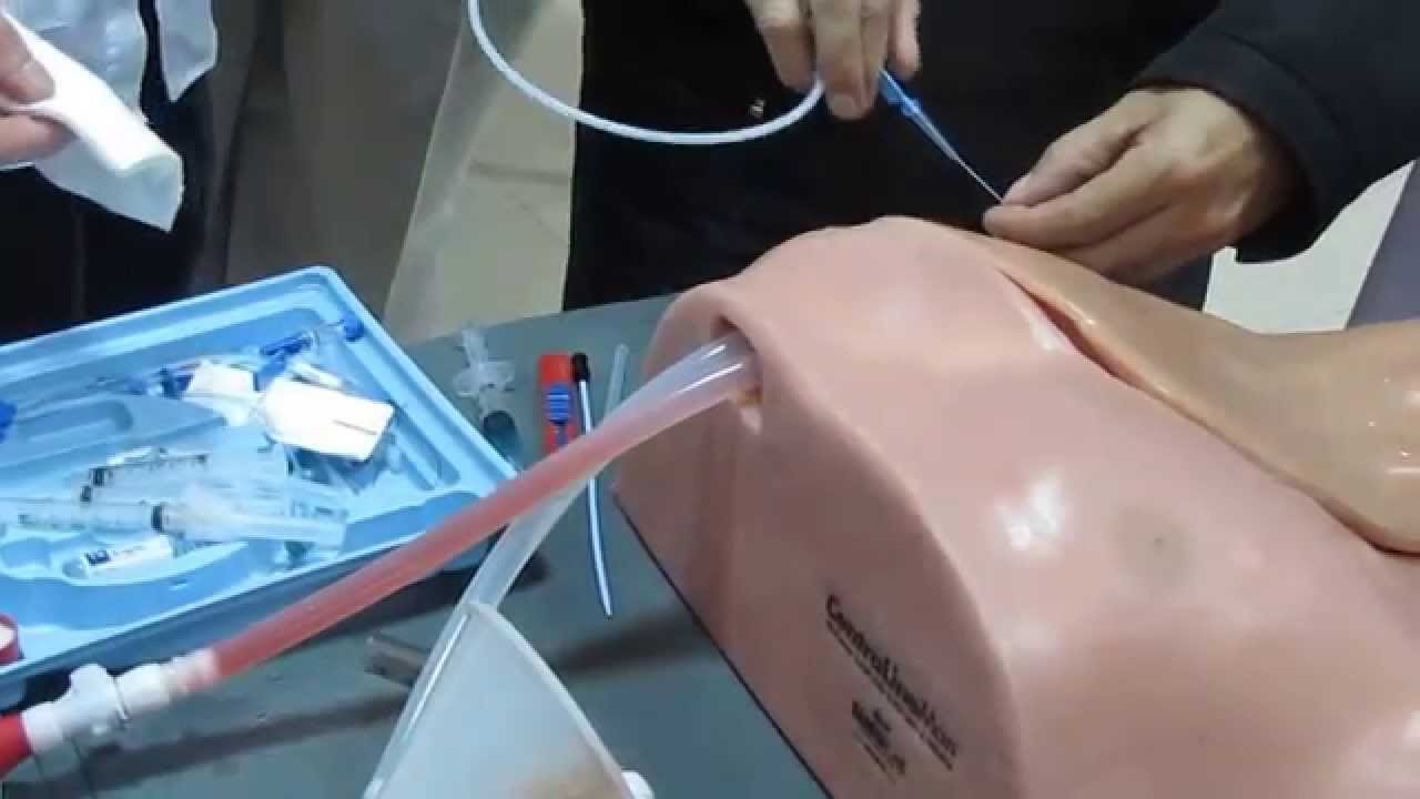 Nhiễm Khuẩn Huyết Trên Bệnh Nhi Đặt Catheter Mạch Máu
