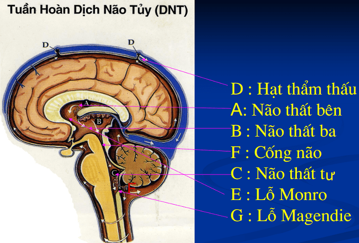 Phân tích ca lâm sàng cấp cứu thần kinh: Chống chỉ định chọc tủy sống