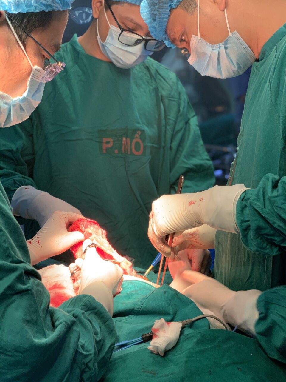 Phẫu Thuật Cắt Bỏ Vú (Patey) + Vét Hạch Nách