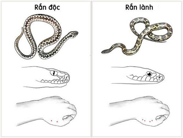 Rắn Cắn