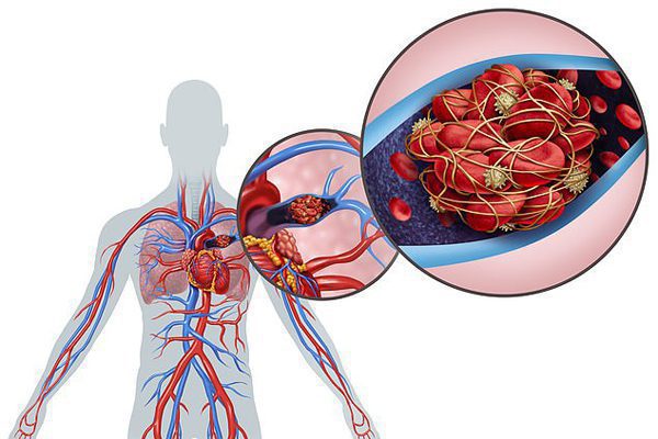 Sinh lý bệnh và nguy cơ của chứng giảm oxy máu thầm lặng trong tổn thương phổi do COVID-19