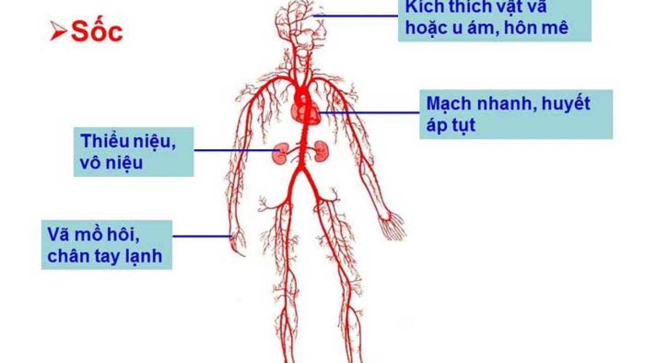 Sốc do giảm thể tích máu