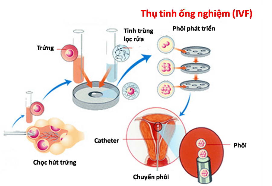 Thông Tư Ban Hành Quy Trình Kỹ Thuật Thụ Tinh Nhân Tạo Và Thụ Tinh Trong Ống Nghiệm