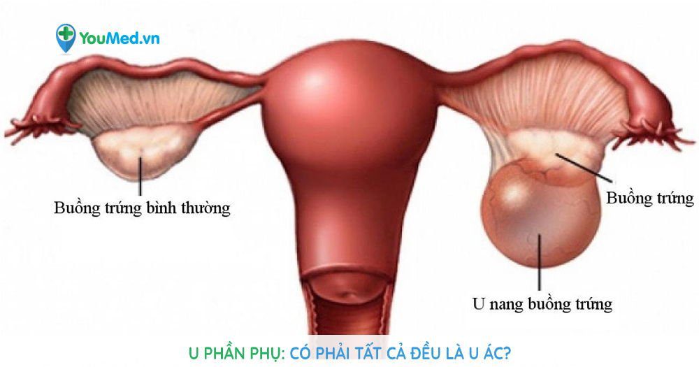 U Phần Phụ