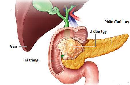 U tụy