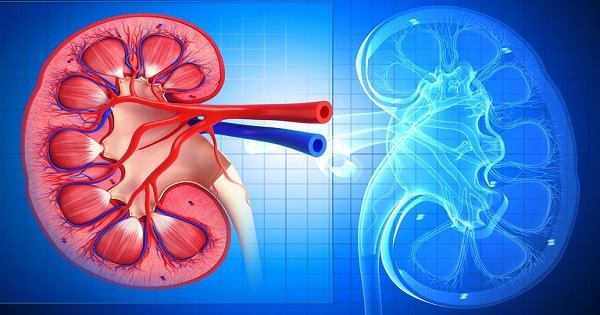 Viêm Thận Lupus