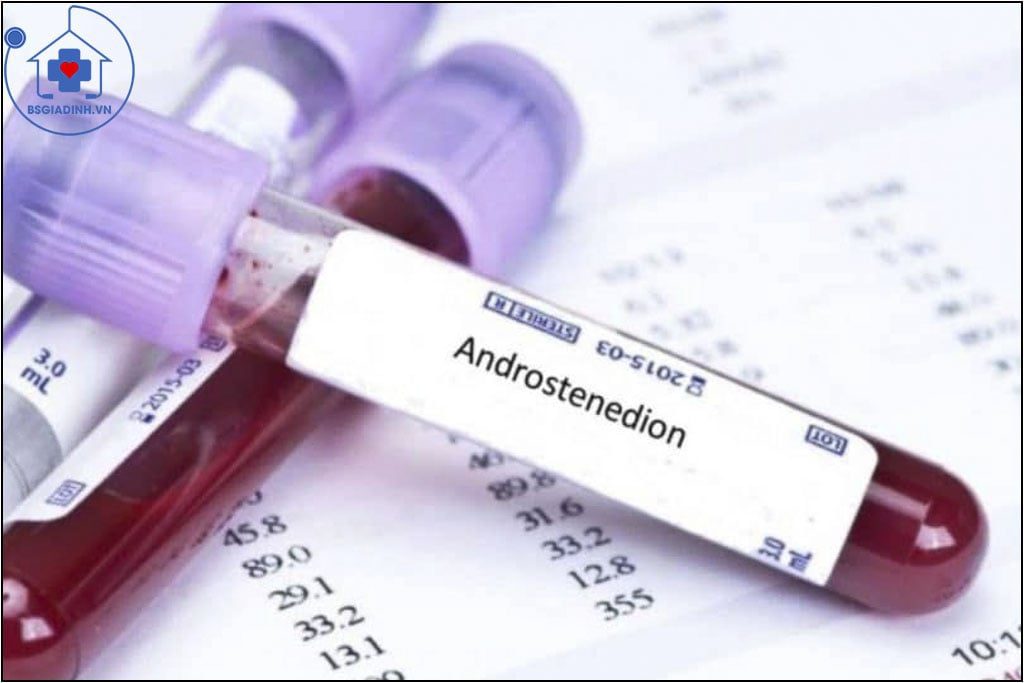 Xét nghiệm Androstenedion