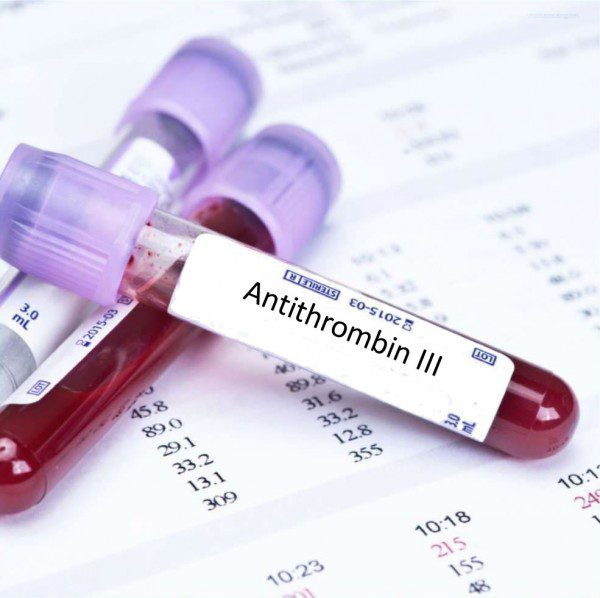 Xét nghiệm Antithrombine III