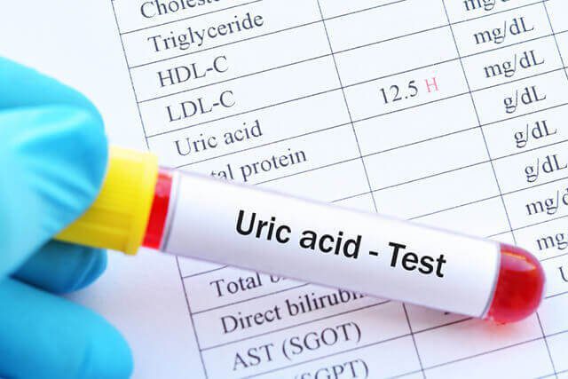 Xét nghiệm Axit Uric