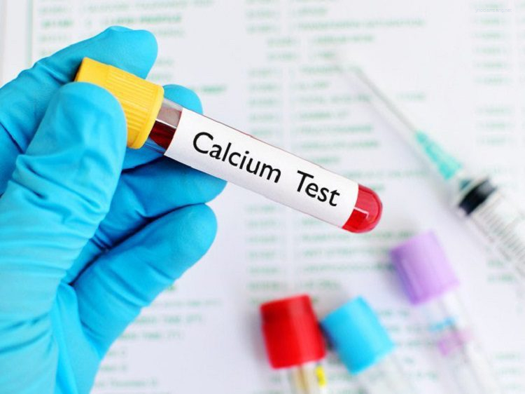 Xét nghiệm Canxi (Calcium)