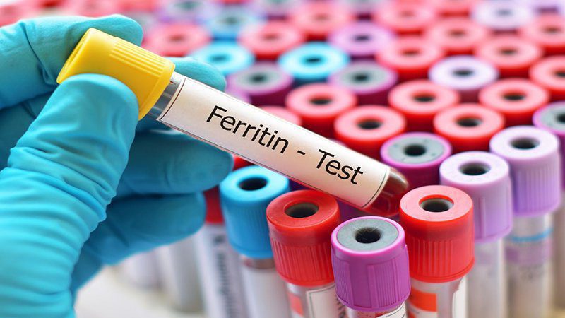Xét nghiệm Ferritin