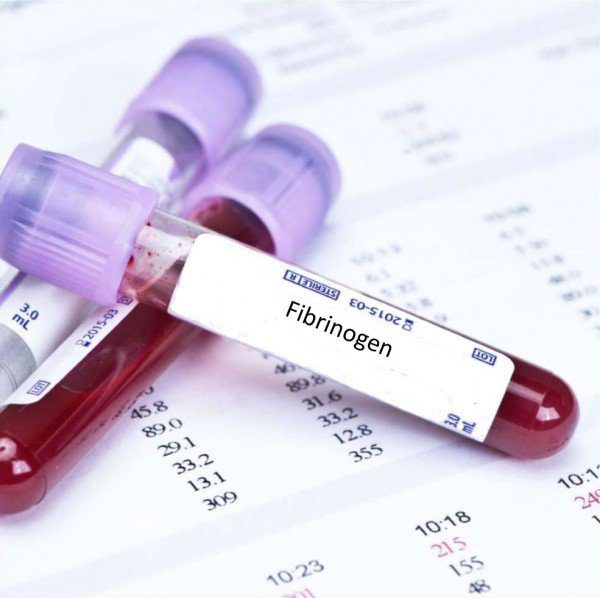 Xét nghiệm Fibrinogen