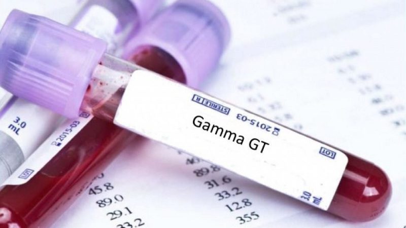 Xét nghiệm Gamma-Glutamyl Transferase (GGT)
