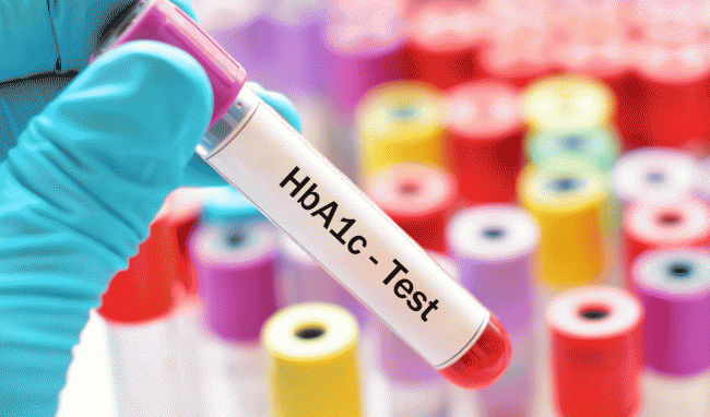 Xét nghiệm HbA1C