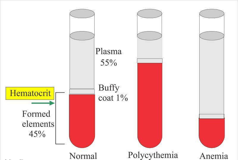 Xét nghiệm Hematocrit (Hct)