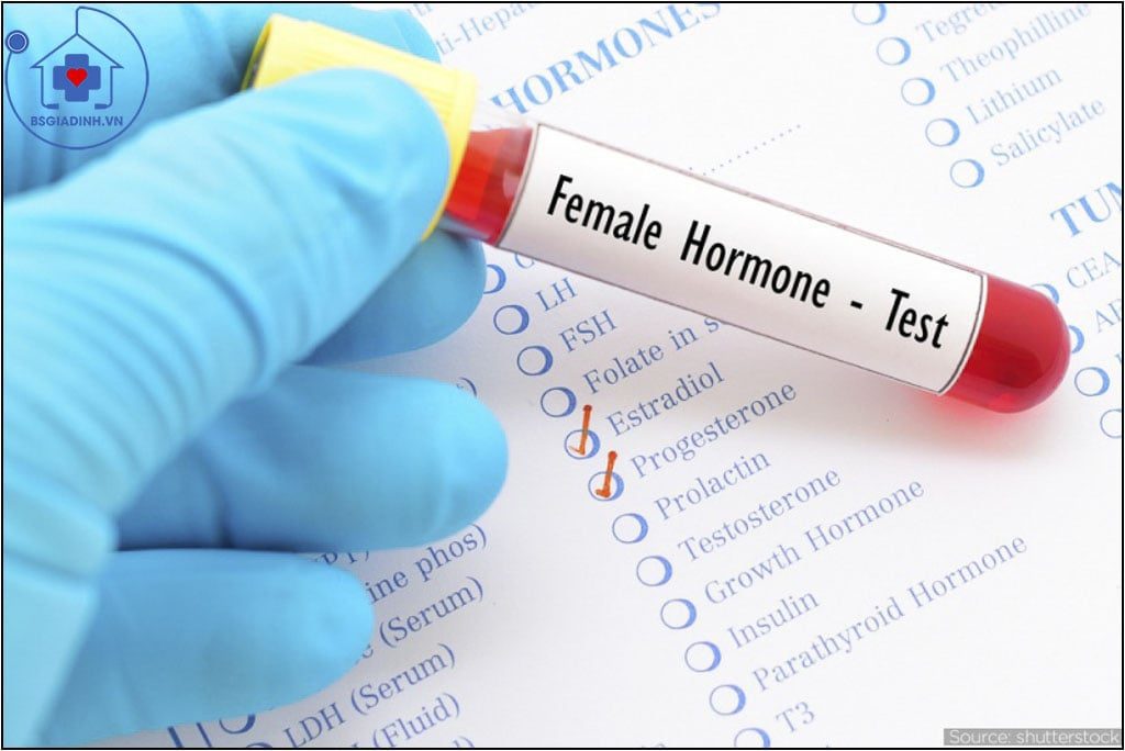 Xét nghiệm Hormon tạo hoàng thể (LH)