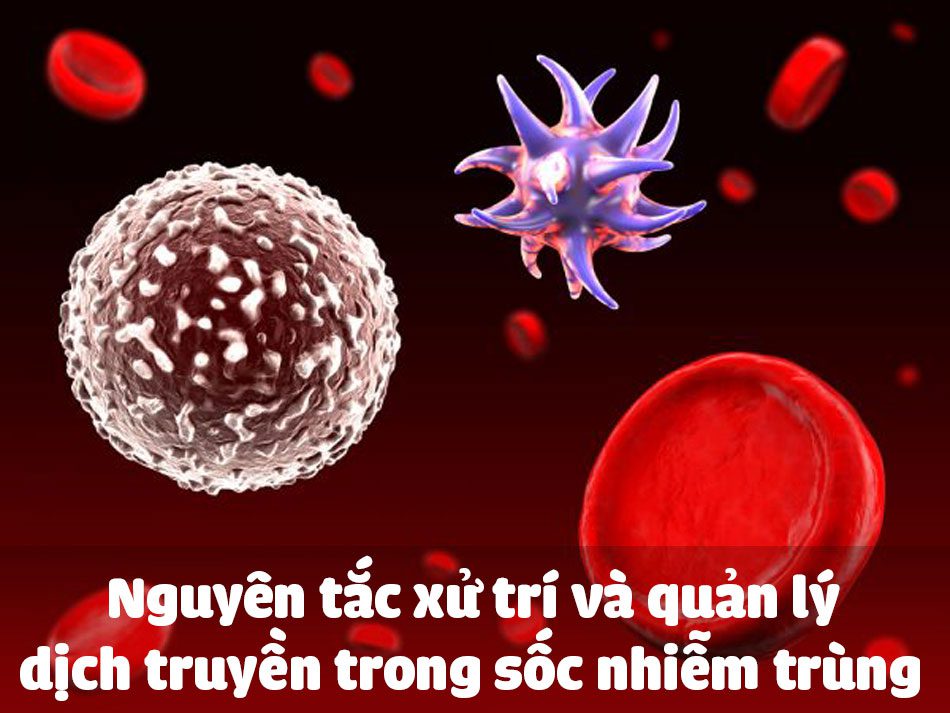 Quản lý dịch truyền trong Sốc nhiễm trùng