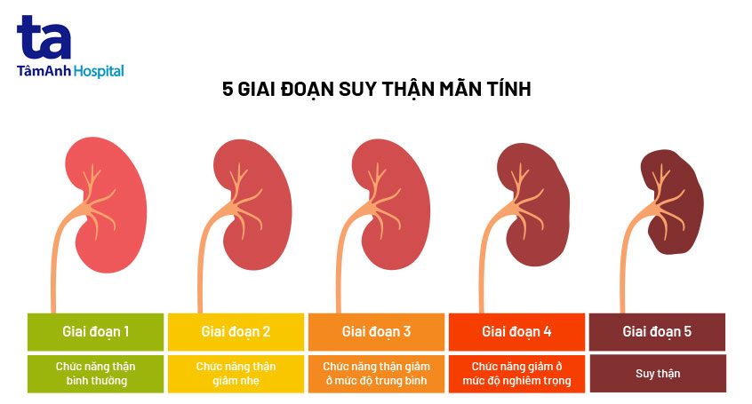 Điều trị chung tăng Calci máu cấp tính và mãn tính ở người lớn