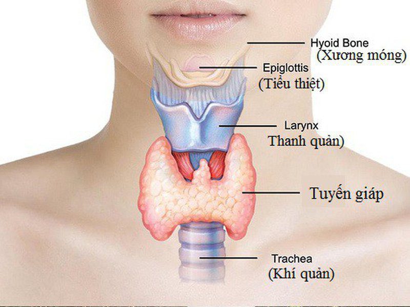 Viêm tuyến giáp truyền nhiễm cấp tính