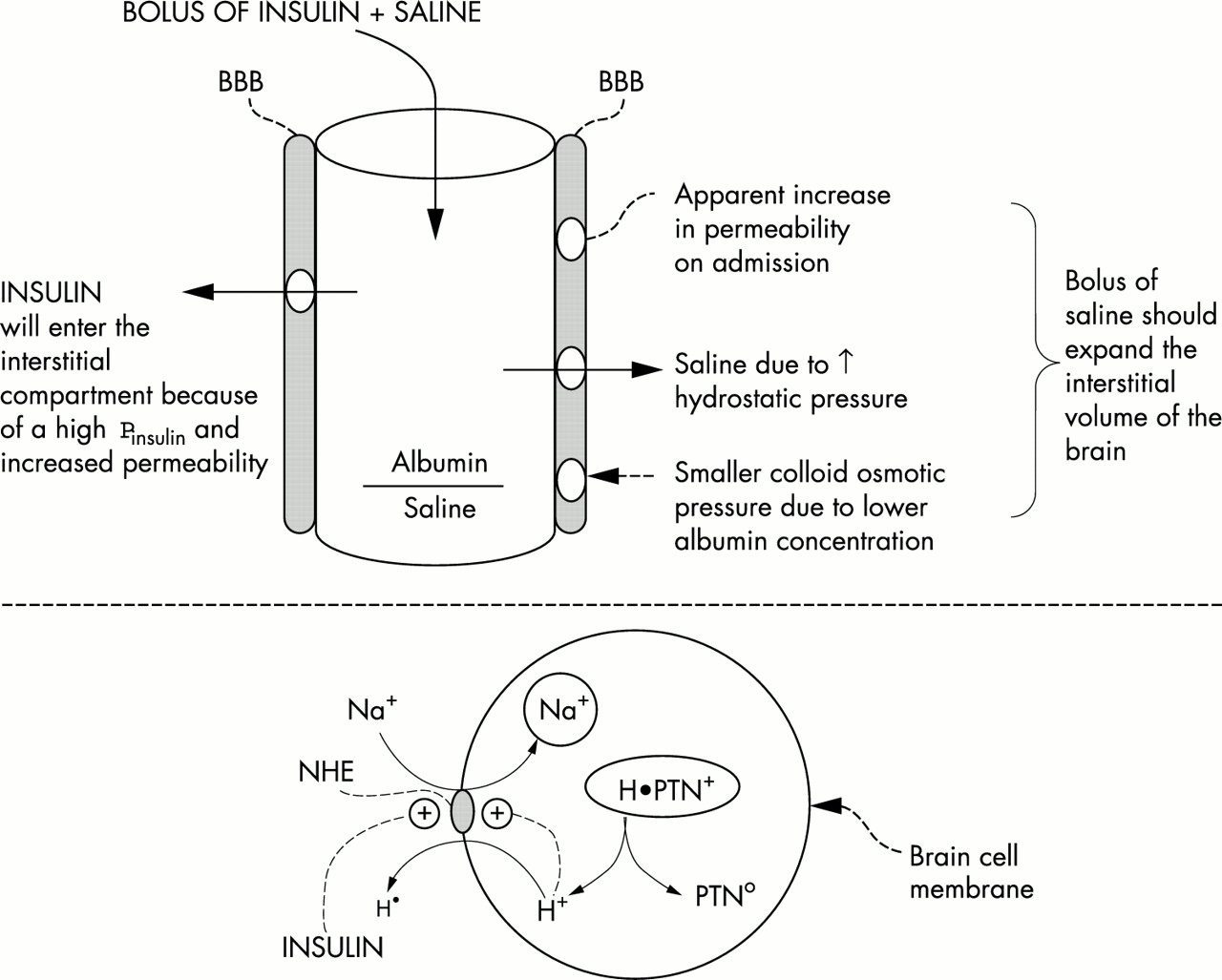 Phù não ở bệnh nhân nhiễm toan ceton do đái tháo đường