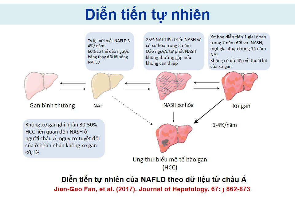 Cập nhật cơ chế bệnh sinh của Bệnh gan nhiễm mỡ không do rượu (NAFLD)