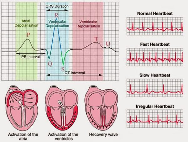 Một số điểm chính cần lưu ý khi diễn giải ECG (điện tâm đồ):