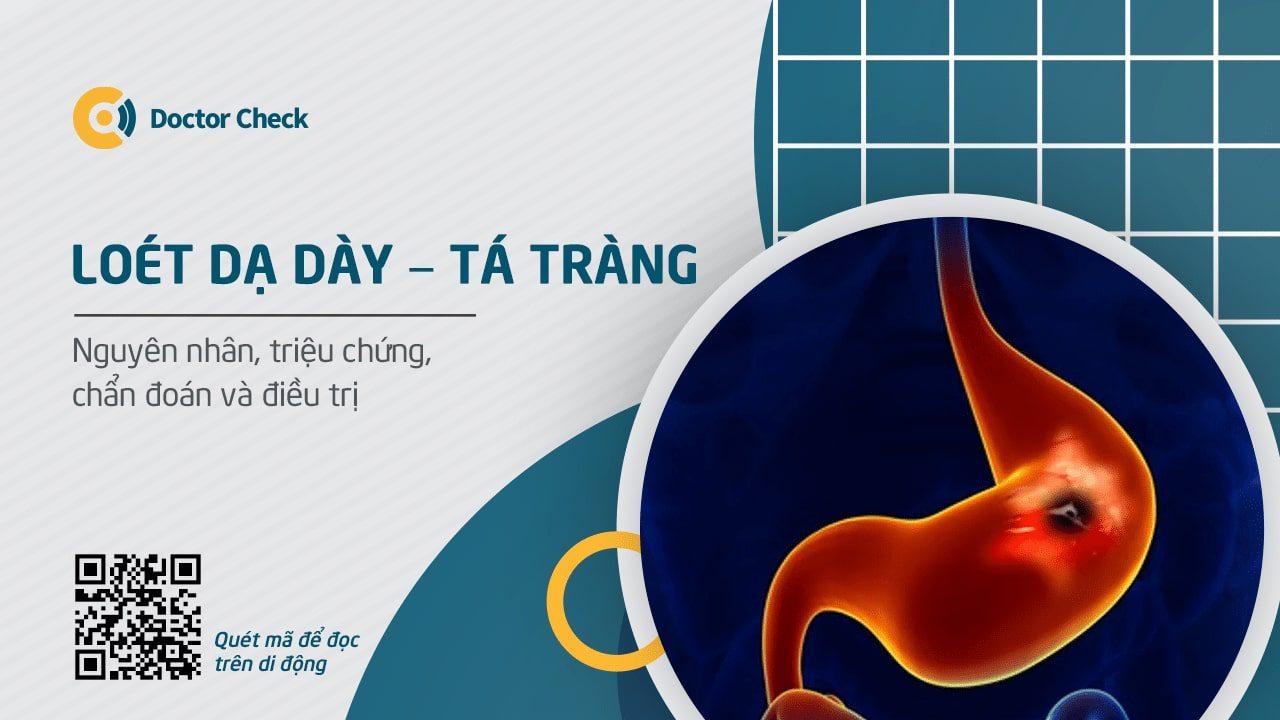 Chẩn đoán và điều trị loét dạ dày tá tràng