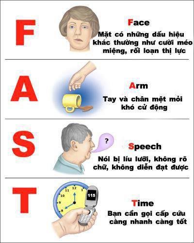 Hướng dẫn chẩn đoán và xử trí đột quỵ não