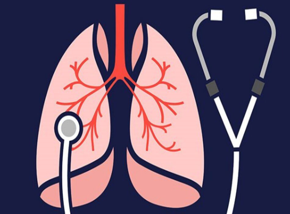 Viêm phổi liên quan đến máy thở ở người lớn: Một tổng quan tường thuật