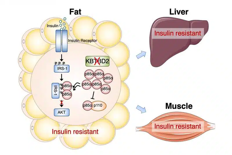 Béo phì và kháng insulin: con đường dẫn đến bệnh mạch máu