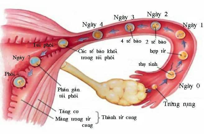 Hội Chứng rối loạn cảm xúc tiền kinh nguyệt