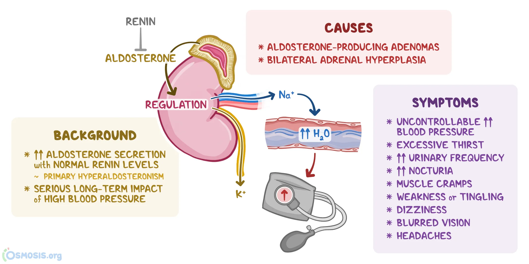 Cường aldosterone nguyên phát (Hội chứng Conn)