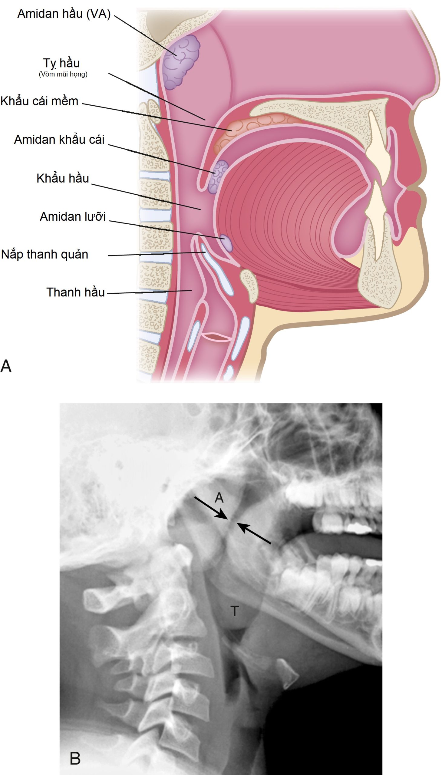 Chẩn đoán Hình ảnh Nhập môn, Ấn bản thứ 5. Chương 27: Nhận biết các Bệnh lý Nhi khoa