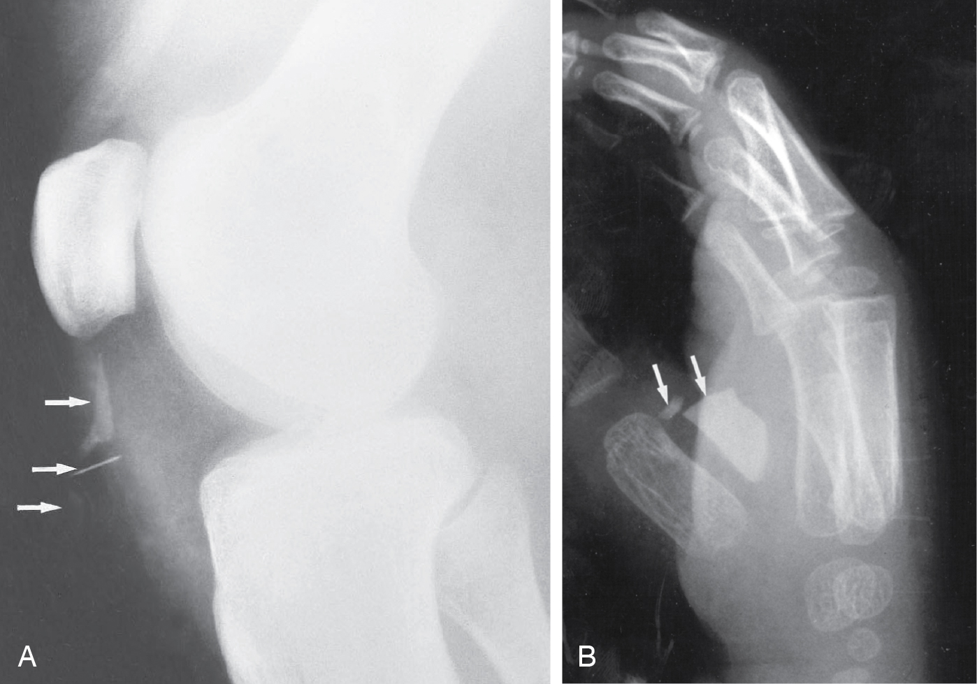 Ngoại khoa Căn bản: Vấn đề, Chẩn đoán và Quản lý, Ấn bản thứ 7 (2026). Chương 17. Tổn thương mô mềm và Bỏng