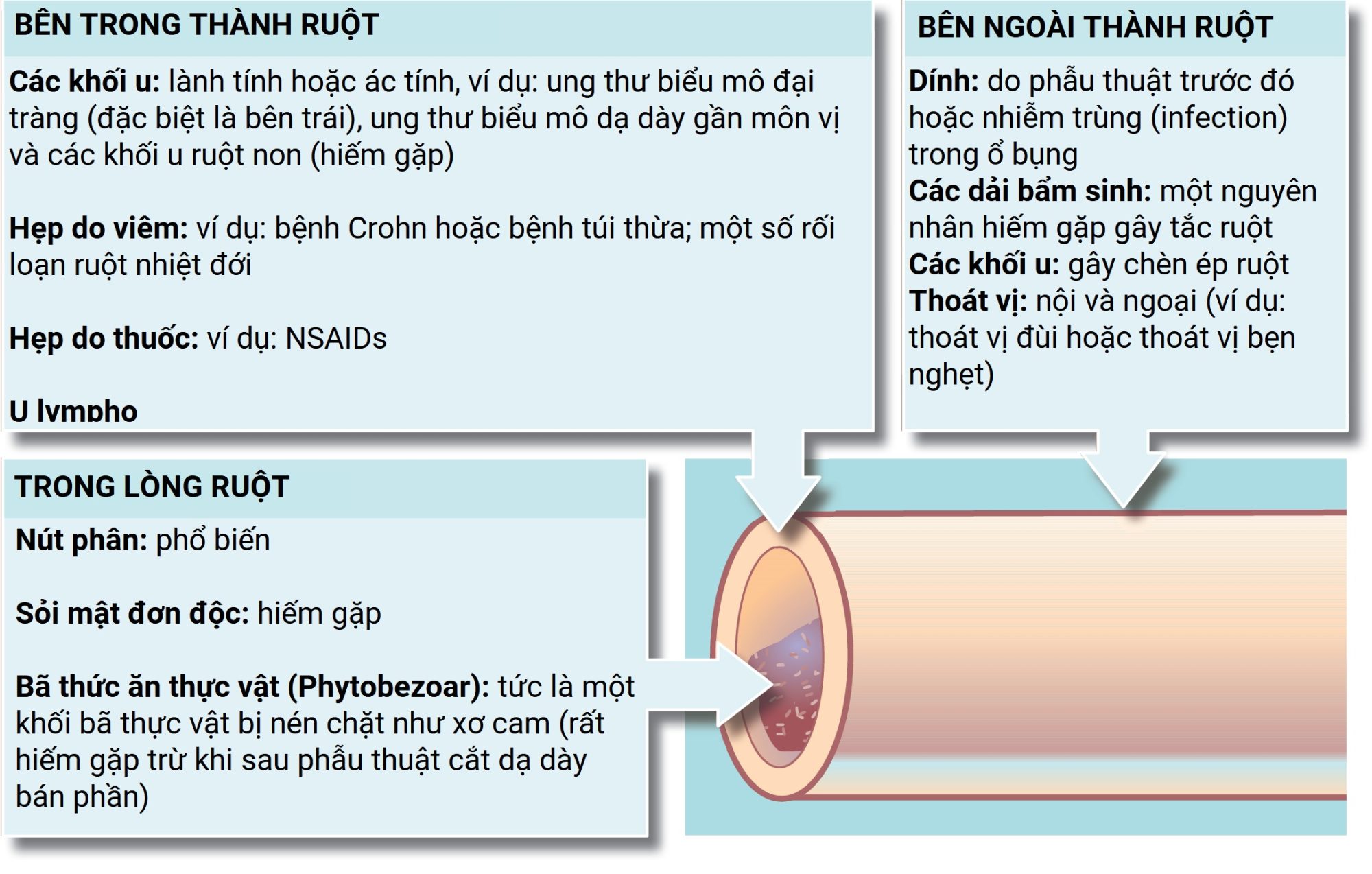 Ngoại khoa Căn bản: Vấn đề, Chẩn đoán và Quản lý, Ấn bản thứ 7 (2026). CHƯƠNG 19. Bụng cấp và Xuất huyết tiêu hóa cấp