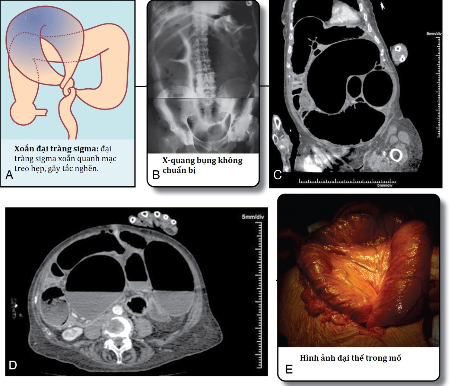 Ngoại khoa Căn bản: Vấn đề, Chẩn đoán và Quản lý, Ấn bản thứ 7 (2026). Chương 29. Rối loạn vận động, cấu trúc và tưới máu đại tràng