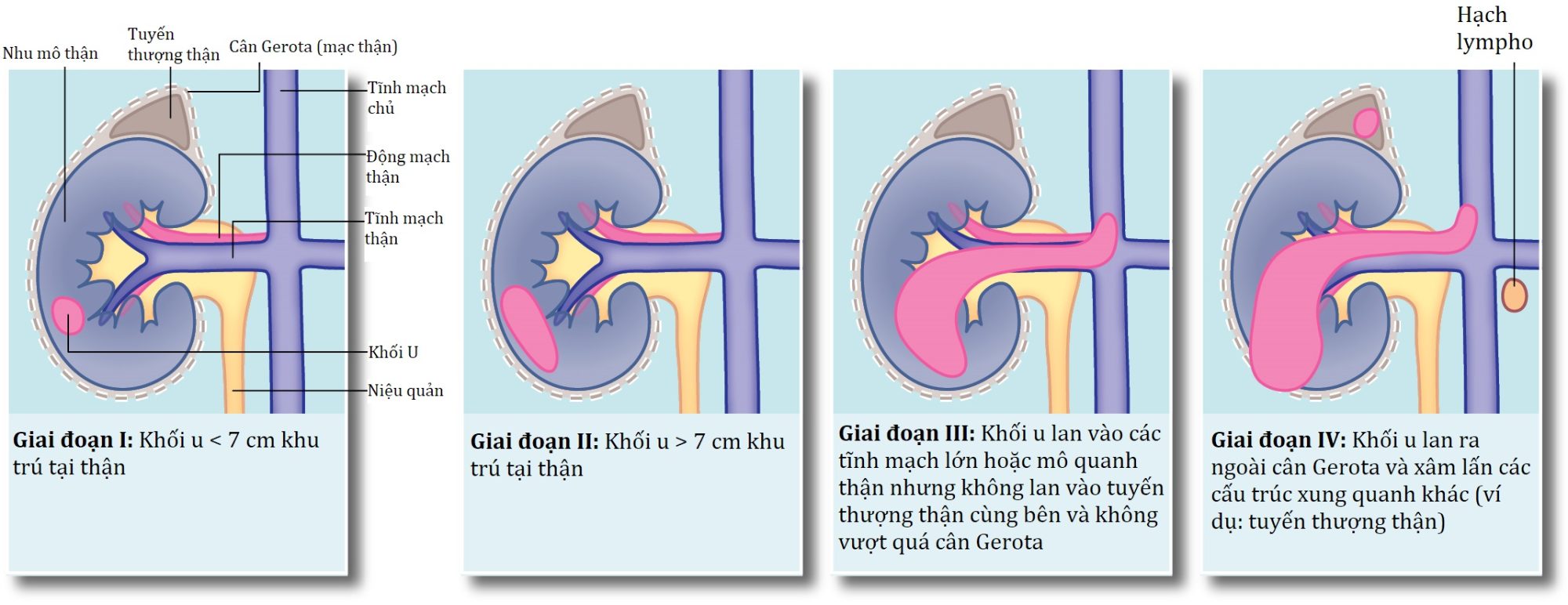 Ngoại khoa Căn bản: Vấn đề, Chẩn đoán và Quản lý, Ấn bản thứ 7 (2026). Chương 36. Các bệnh lý của thận, niệu quản và bàng quang