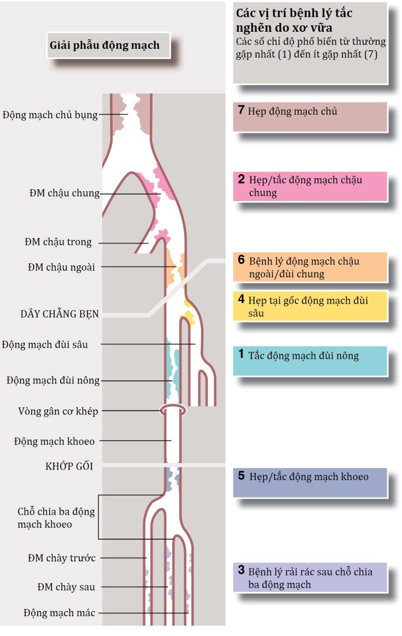 Ngoại khoa Căn bản: Vấn đề, Chẩn đoán và Quản lý, Ấn bản thứ 7 (2026). CHƯƠNG 40. Xử trí thiểu năng động mạch chi dưới, bàn chân đái tháo đường và các phẫu thuật cắt cụt lớn